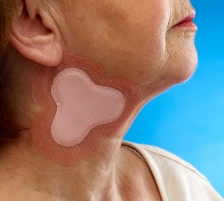 Allevyn Gentle Border multisite neck