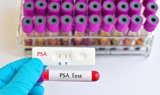 PSA-Test Früherkennung Prostatakrebs