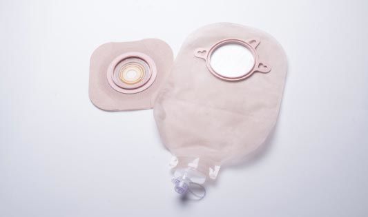 Urostoma nach Zystektomie