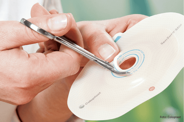 Coloplast Stomaplatte wird zurechtgeschnitten