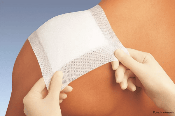 Fixiervlies wird auf der Schulter angebracht
