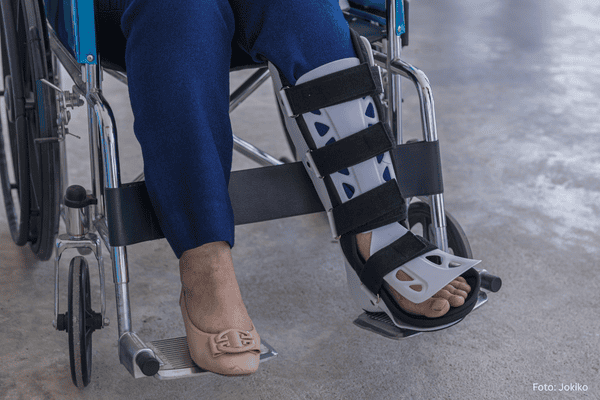 Seniorin mit Beinorthese / Orthese / Bandage