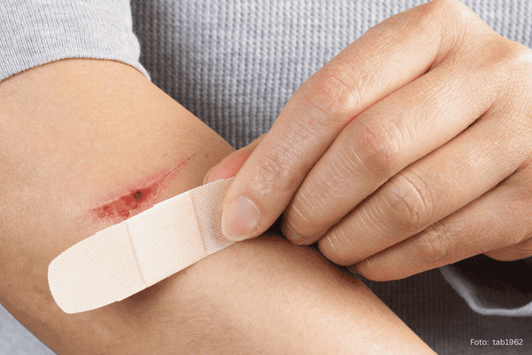 Wunde wird mit Wundmaterial versorgt